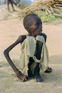 Child-starving-sudan-3.jpg