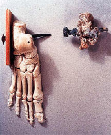 http://www.markdroberts.com/images/Crucifixion-bones-3.jpg